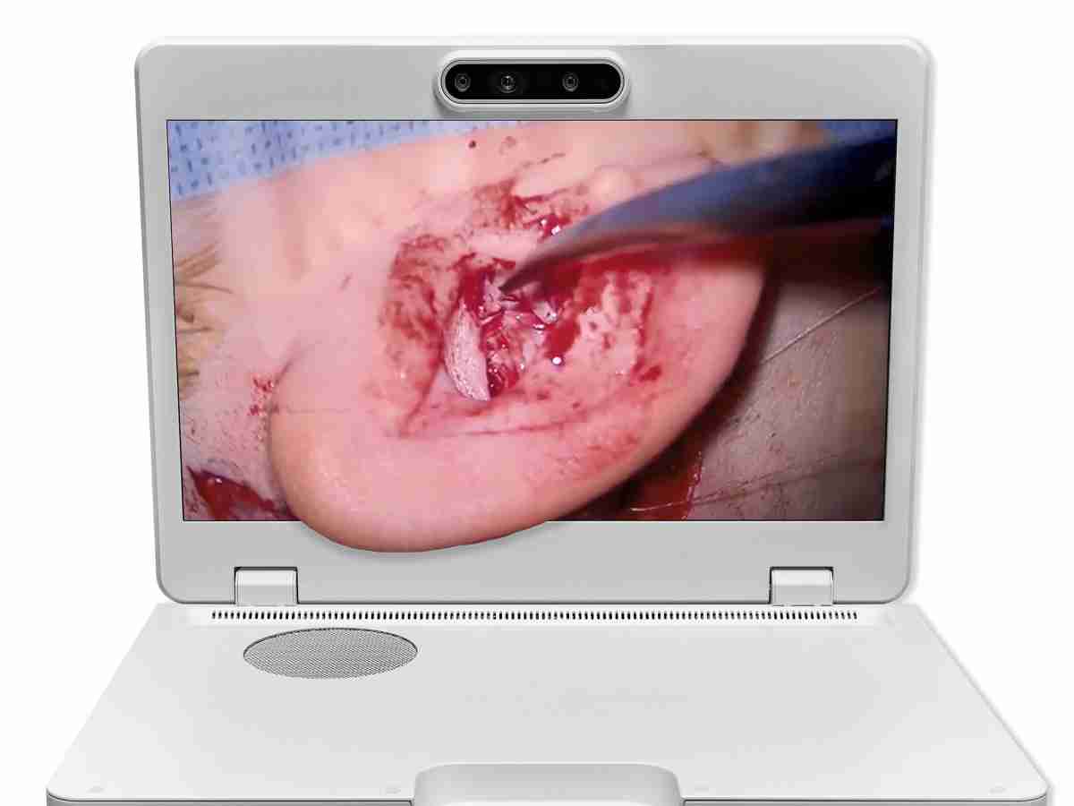 达擎之＂Heads-up 3D显微手术显示系统＂，，，整合4K裸眼3D显示及眼球追踪系统，，，具备快速追踪人眼移动位置功能，，，，减轻医师长时间维持固定姿势的负担，，，让医师能有更宽广清晰的3D立体视野及更舒适的姿势来执行手术。。。。